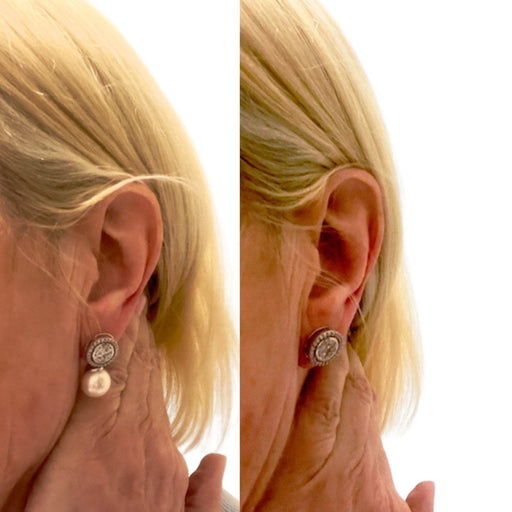 Boucles d'oreilles Boucles d'oreilles modernes en or 18 ct avec diamants et perle 58 Facettes Q5B